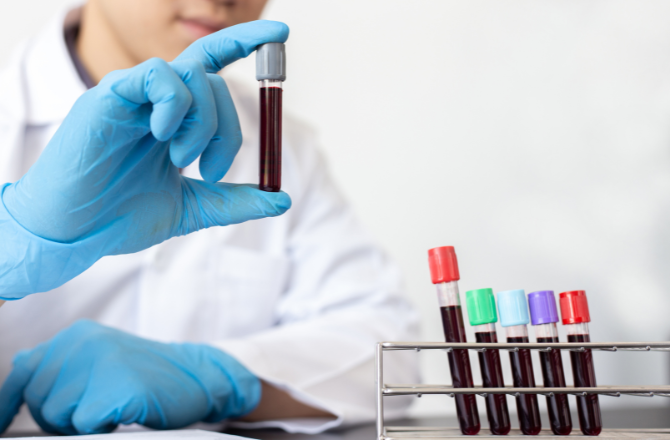 O que significam as siglas PDW e VPM no resultado de um hemograma?