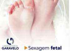 Sexagem fetal