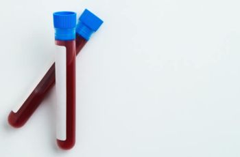 Infecções silenciosas que podem ser diagnosticadas em exames laboratoriais