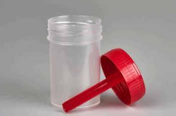 Para que serve o exame de fezes?