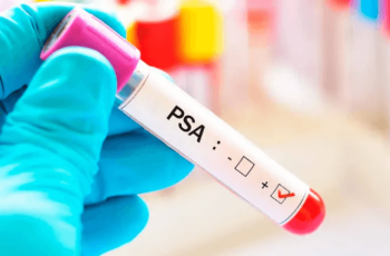 PSA substitui o exame de toque retal?