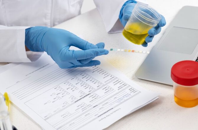 Como funciona o exame toxicológico?