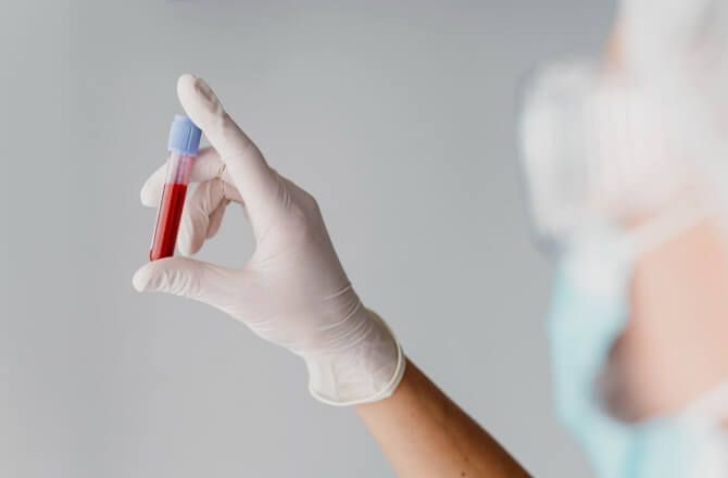 Conheça os principais tipos de anemia!