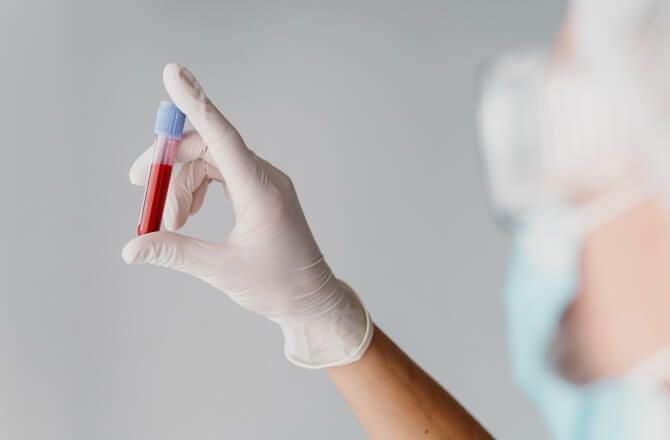 Conheça sete exames de sangue que ajudam a identificar problemas no coração